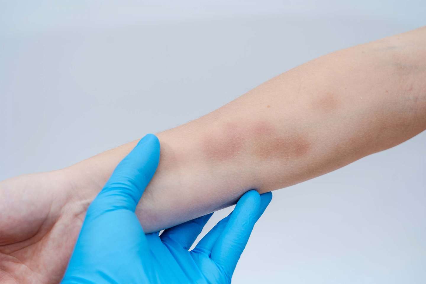 Médecins : forte hausse des violences signalées